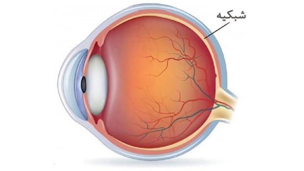 Retinal (1) Retinal بیماری های شبکیه چشم
