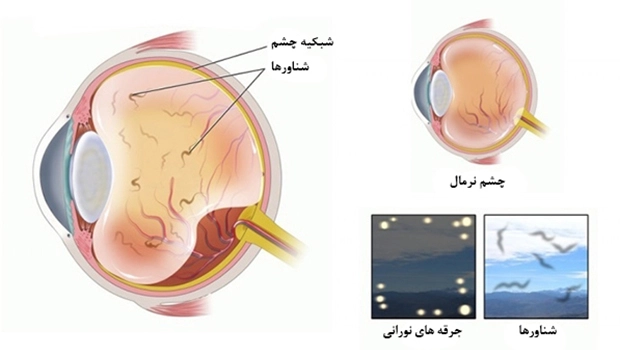 Retinal (4)