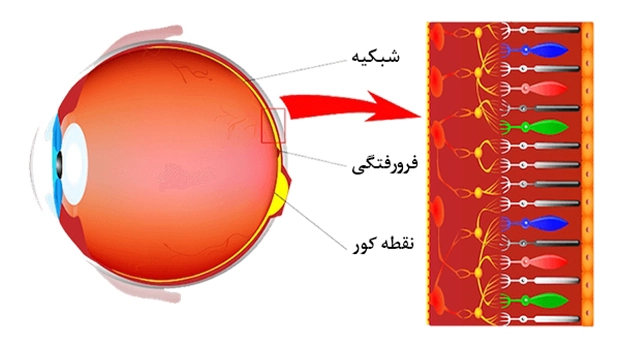 Retinal (6) بیماری های شبکیه چشم
