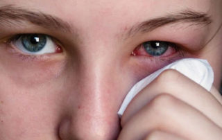 مخاط چشم هم از ویروس کرونا در امان نیست