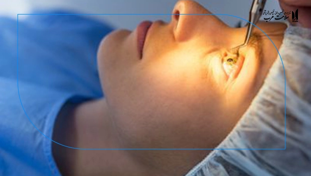 لازک، دری به دنیای بدون عینک