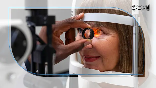 نقش ضخامت قرنیه در پیش بینی عوارض طولانی مدت