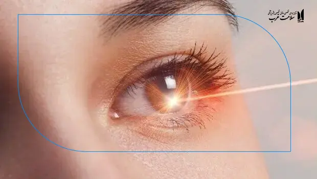 عمل ترنس پی آر کی چگونه انجام می شود؟