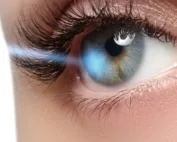 برای همیشه از عینک خداحافظی کن (لازک)