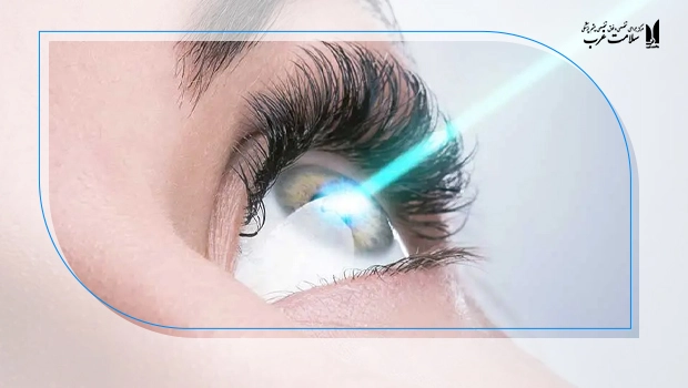 lasik-corneal-incision-no-side