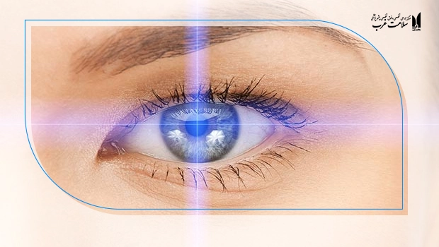 کاربردهای پیشنهادی و کاندیدای ایده‌آل لازک