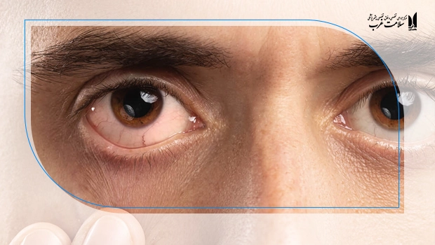 علل بسیار خطرناک و اورژانسی تاری دید ناگهانی