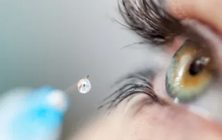 رتینوپاتی دیابتی: درمان‌های نوین 2025