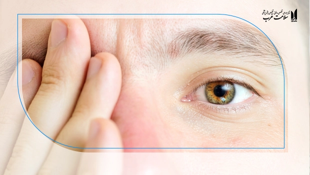تنبلی چشم و مکانیسم ایجاد آن