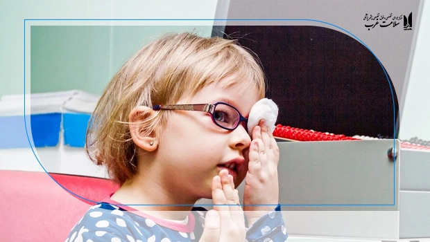 روش‌های درمان تنبلی چشم