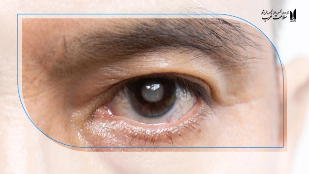 پیشگیری از کاهش بینایی در سالمندی