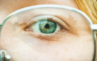 پیشگیری از کاهش بینایی در سالمندی