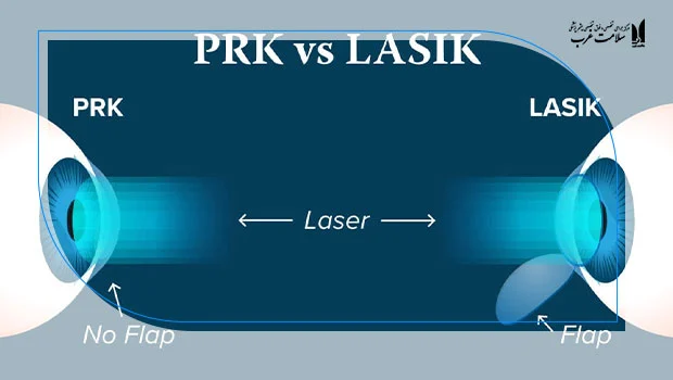 آیا عمل PRK دائمی است؟