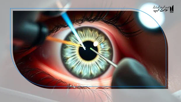 چه زمانی بعد از لازک میتوان رانندگی کرد؟